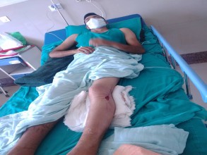 बैतडीका क्यान्सर पिडीत भट्टको उपचारमा समस्या, आर्थिक सहयोग गर्न अपिल 